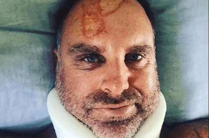 Jonty Rhodes Spots 'The Map Of Tamil Nadu' On Matthew Hayden's Head Injury