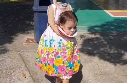 Girl\'s Halloween costume looks like she is carrying her severed head